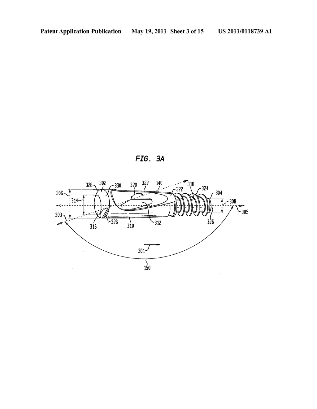 Intramedullary fixation assembly and method of use - diagram, schematic, and image 04