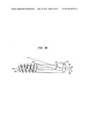 Intramedullary fixation assembly and method of use diagram and image