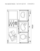 Integrated Surgical Cutting System diagram and image