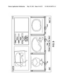 Integrated Surgical Cutting System diagram and image