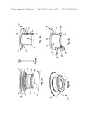 Attachment System, Device and Method diagram and image