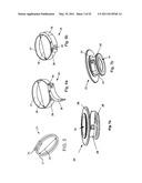 Attachment System, Device and Method diagram and image