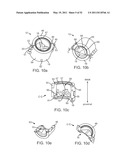 Attachment System, Device and Method diagram and image