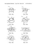 Attachment System, Device and Method diagram and image