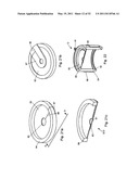 Attachment System, Device and Method diagram and image