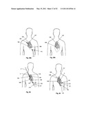 Attachment System, Device and Method diagram and image