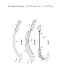 Attachment System, Device and Method diagram and image