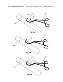 Attachment System, Device and Method diagram and image