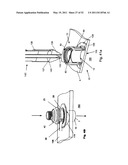 Attachment System, Device and Method diagram and image