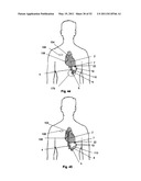 Attachment System, Device and Method diagram and image