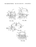 Attachment System, Device and Method diagram and image