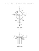 Attachment System, Device and Method diagram and image