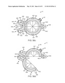 Attachment System, Device and Method diagram and image