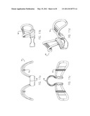 MULTI-LAYER INTERNAL NASAL DILATOR WITH TUBULAR EXPANDERS AND COMPOUND DELIVERY PROTRUSIONS diagram and image