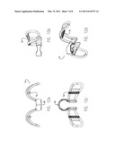 MULTI-LAYER INTERNAL NASAL DILATOR WITH TUBULAR EXPANDERS AND COMPOUND DELIVERY PROTRUSIONS diagram and image