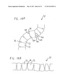 DEVICES FOR INTRODUCTION INTO A BODY VIA A SUBSTANTIALLY STRAIGHT CONDUIT TO FOR A PREDEFINED CURVED CONFIGURATION, AND METHODS EMPLOYING SUCH DEVICES diagram and image