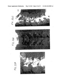 DEVICES FOR INTRODUCTION INTO A BODY VIA A SUBSTANTIALLY STRAIGHT CONDUIT TO FOR A PREDEFINED CURVED CONFIGURATION, AND METHODS EMPLOYING SUCH DEVICES diagram and image