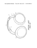 EARMUFF ASSEMBLY diagram and image