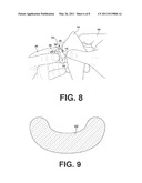 Pest Entrapment Device and Method diagram and image