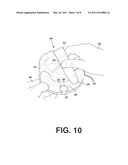 Pest Entrapment Device and Method diagram and image