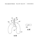 SINGLE-USE INTERNAL DOSIMETERS FOR DETECTING RADIATION IN MEDICAL PROCEDURES/THERAPIES diagram and image