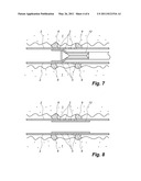 METHOD FOR SEALING OFF A WATER ZONE IN A PRODUCTION WELL DOWNHOLE AND A SEALING ARRANGEMENT diagram and image