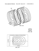 SELF-SHIELDED GRADIENT COIL diagram and image