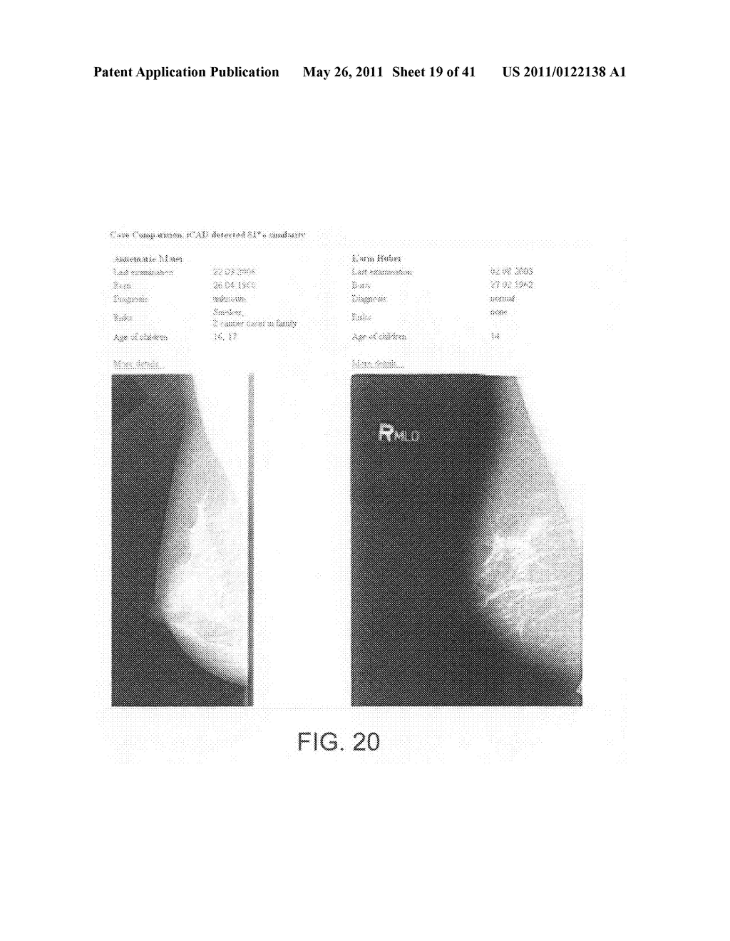 Context driven image mining to generate image-based biomarkers - diagram, schematic, and image 20