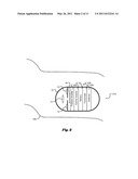 SYSTEM AND METHOD FOR IMAGE ENHANCEMENT OF DARK AREAS OF CAPSULE IMAGES diagram and image