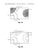 SYSTEM AND METHOD FOR IMAGE ENHANCEMENT OF DARK AREAS OF CAPSULE IMAGES diagram and image