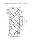 MARKER IDENTIFICATION AND PROCESSING IN X-RAY IMAGES diagram and image