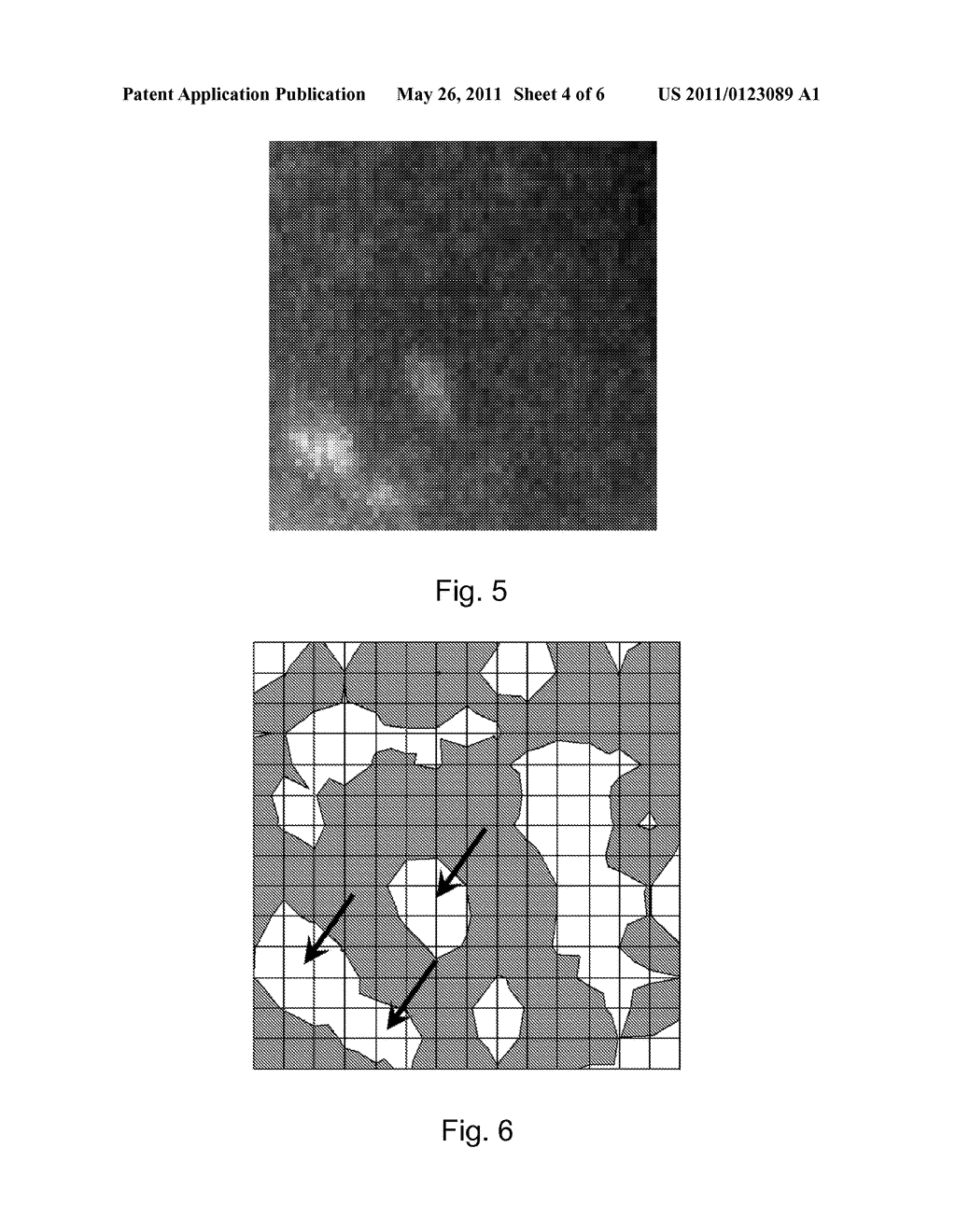 Method and System for Enhancing Contrast of Spatially-Localized Phenomena in Mammography Image - diagram, schematic, and image 05