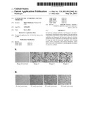 Tumor specific antibodies and uses therefor diagram and image