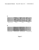 Tumor specific antibodies and uses therefor diagram and image