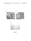 Tumor specific antibodies and uses therefor diagram and image