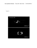 METHODS OF ISOLATING NON-SENESCENT CARDIAC STEM CELLS AND USES THEREOF diagram and image