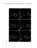 METHODS OF ISOLATING NON-SENESCENT CARDIAC STEM CELLS AND USES THEREOF diagram and image