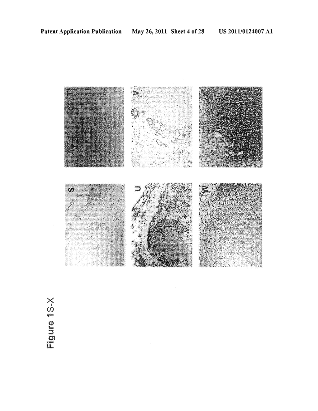 UTILITY OF HIGH MOLECULAR WEIGHT MELANOMA ASSOCIATED ANTIGEN IN DIAGNOSIS AND TREATMENT OF CANCER - diagram, schematic, and image 05