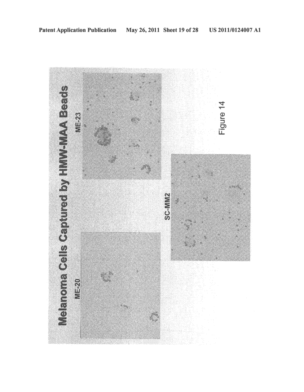 UTILITY OF HIGH MOLECULAR WEIGHT MELANOMA ASSOCIATED ANTIGEN IN DIAGNOSIS AND TREATMENT OF CANCER - diagram, schematic, and image 20