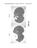 METHODS OF TREATING TRAUMATIC BRAIN INJURY BY ADMINISTERING BAICALEIN PREPARATION diagram and image