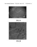 METHODS OF TREATING TRAUMATIC BRAIN INJURY BY ADMINISTERING BAICALEIN PREPARATION diagram and image