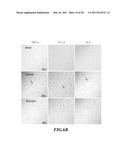 METHODS OF TREATING TRAUMATIC BRAIN INJURY BY ADMINISTERING BAICALEIN PREPARATION diagram and image