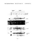 Treatment Of Neurodegenerative Diseases And Cancer Of The Brain Using Histone Deacetylase Inhibitors diagram and image