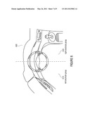 SIGNAL DETECTING DEVICE FOR DETECTING A DIFFERENCE SIGNAL FOR AN ELECTRICAL MEASUREMENT OF A VITAL PARAMETER OF A LIVING BEING, ELECTRODE ARRANGEMENT AND METHOD diagram and image