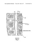 METHODS AND DEVICES FOR SENSING TISSUES AND TISSUE COMPARTMENTS diagram and image