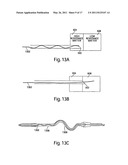 METHODS AND DEVICES FOR SENSING TISSUES AND TISSUE COMPARTMENTS diagram and image