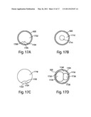 METHODS AND DEVICES FOR SENSING TISSUES AND TISSUE COMPARTMENTS diagram and image