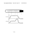 Light-Based Method for the Endovascular Treatment of Pathologically Altered Blood Vessels diagram and image