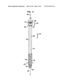 INTRAMEDULLARY FIXATION ASSEMBLY AND METHOD OF USE diagram and image