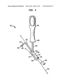 INTRAMEDULLARY FIXATION ASSEMBLY AND METHOD OF USE diagram and image